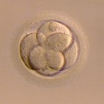 肝芽腫の再発に関する仮説シリーズ　まとめ